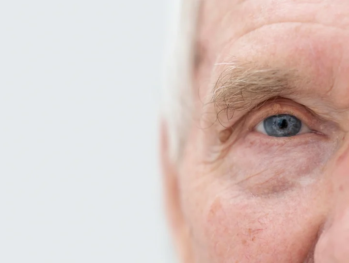 Dia Mundial do Glaucoma