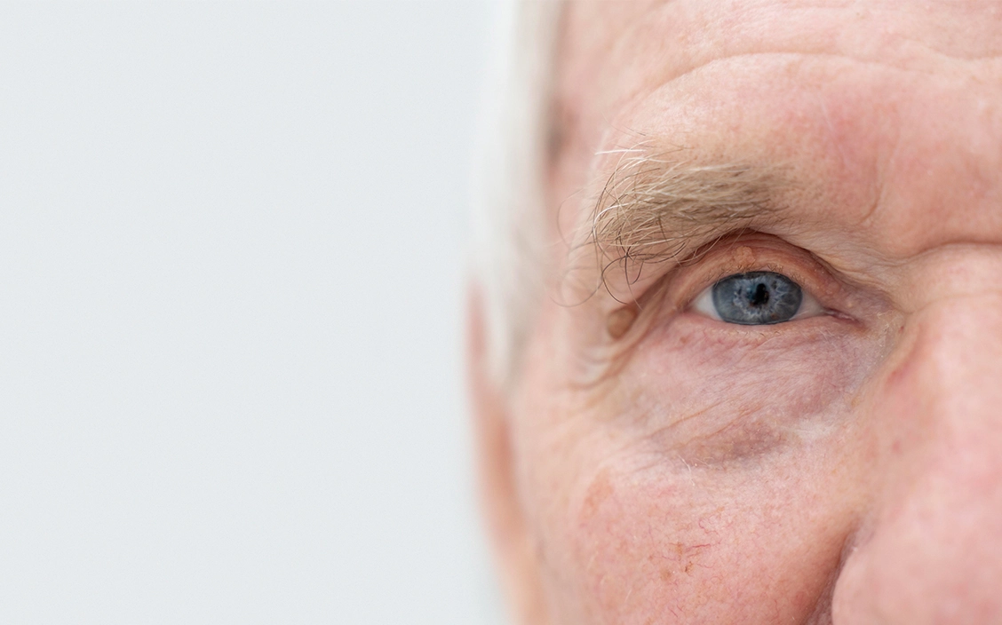 Dia Mundial do Glaucoma